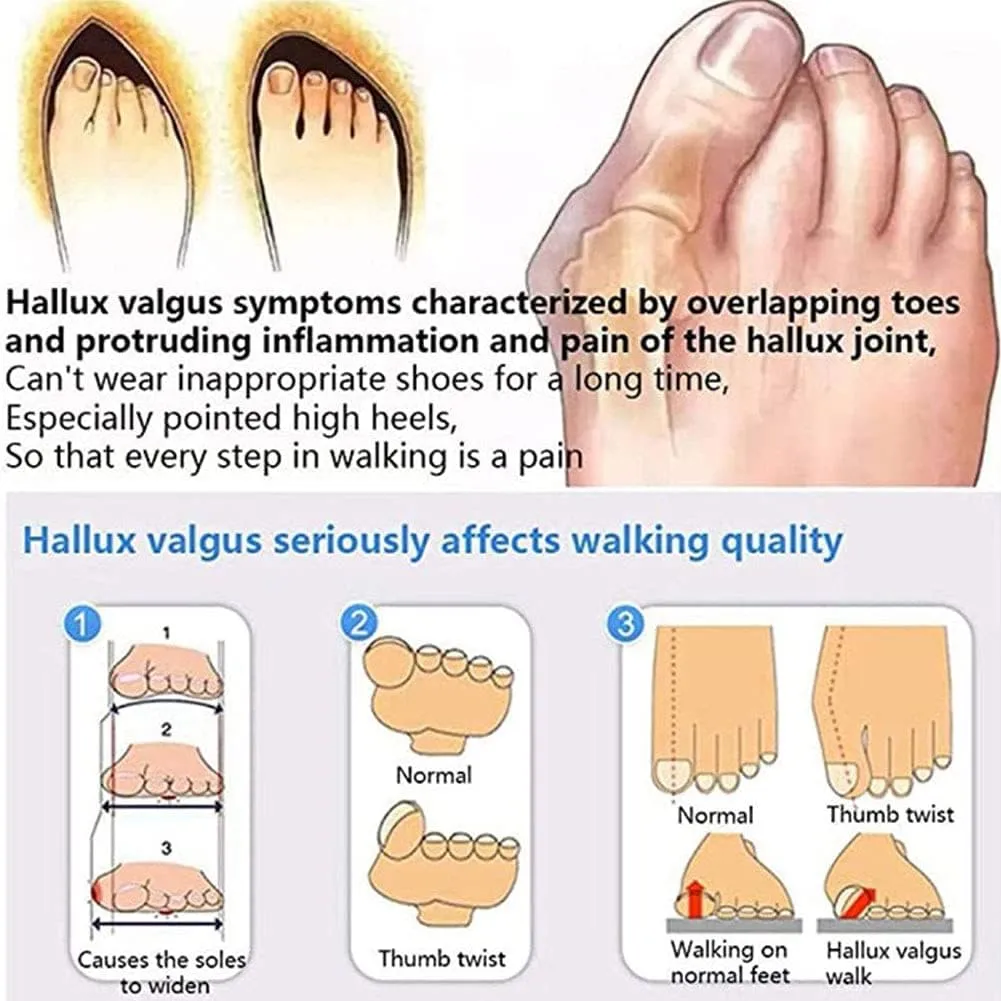 Womens Summer Fashion Sandals, Open Toe Retro Fashion Ladies Shoes Beach Shoes,Orthopedic Casual Slip On Flip Flops Lightweight Flat Shoes